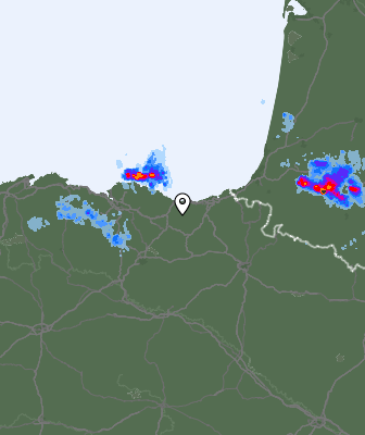 Radar