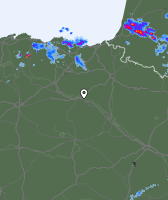 Radar