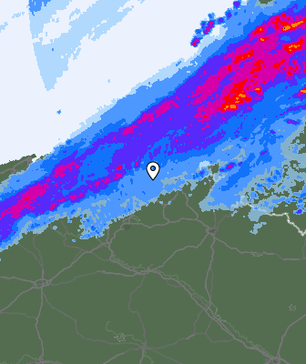 Radar