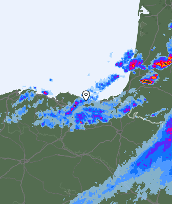 Radar
