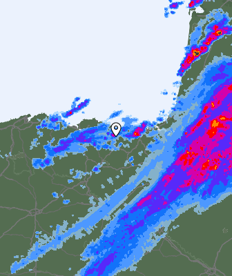 Radar