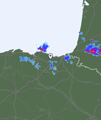 Radar
