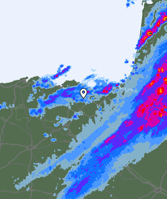 Radar