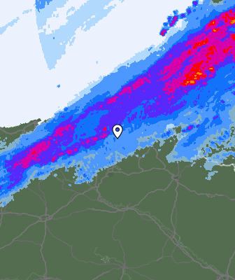 Radar