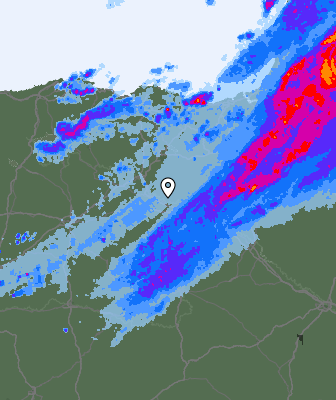 Radar