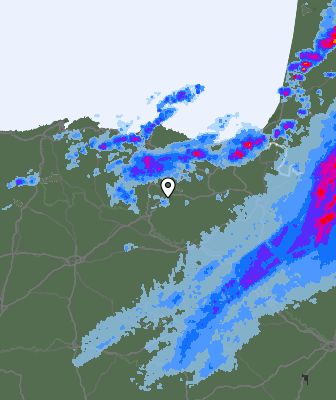 Radar
