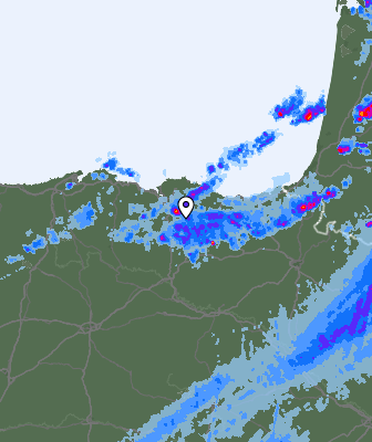 Radar