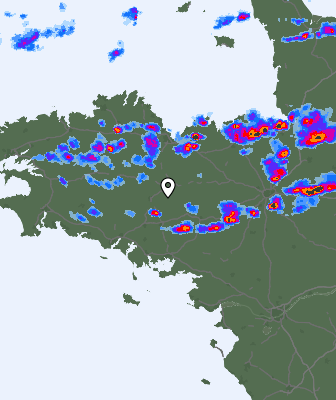Radar