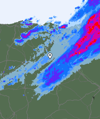 Radar