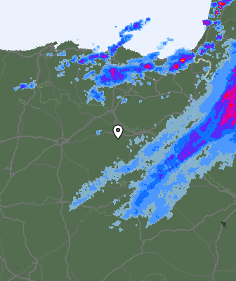 Radar