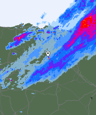 Radar