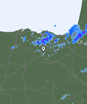 Radar