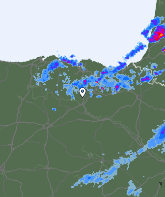 Radar
