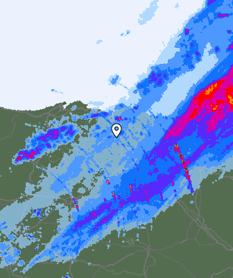 Radar