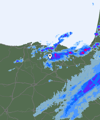 Radar