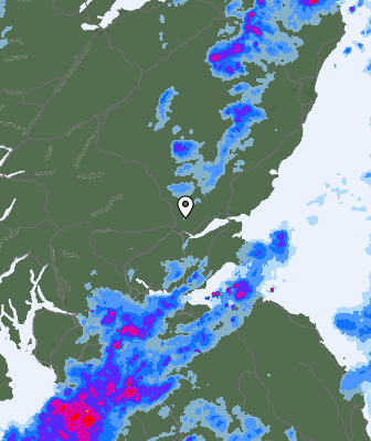 Radar