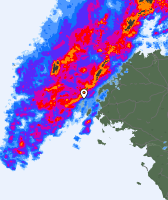 Radar