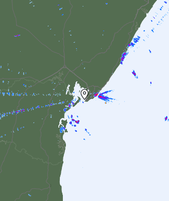 Radar