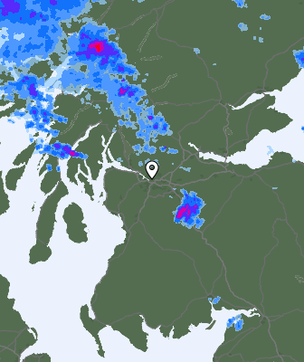 Radar