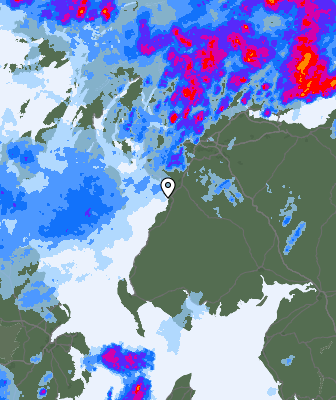 Radar