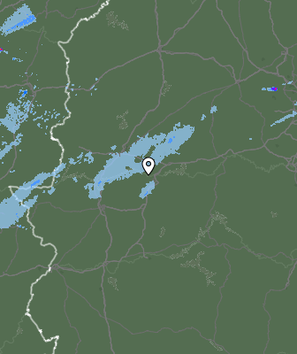 Radar