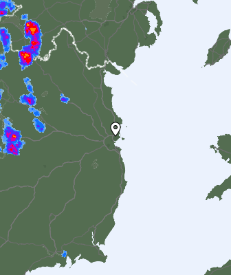 Radar