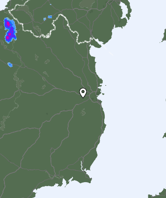 Radar