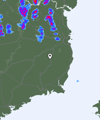 Radar