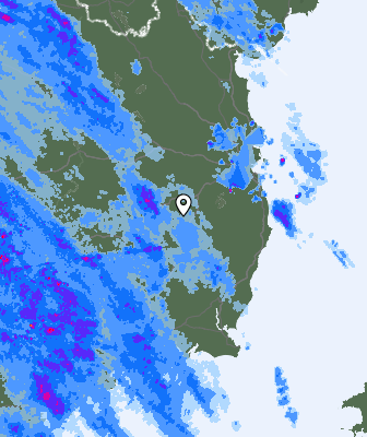 Radar