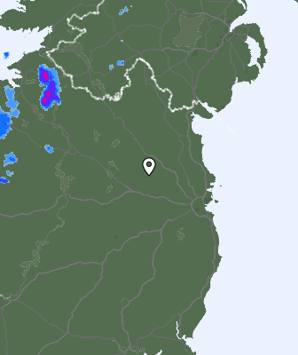 Radar