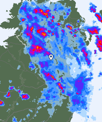 Radar