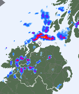 Radar