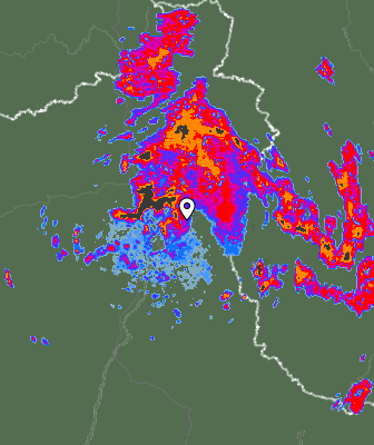 Radar