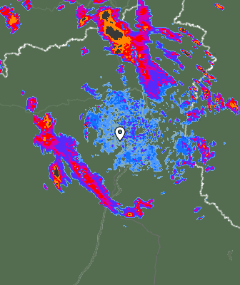 Radar