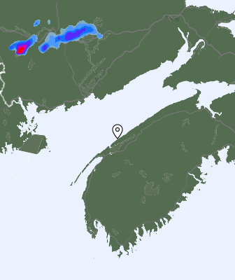 Radar