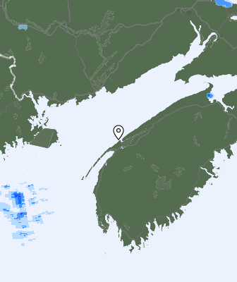 Radar