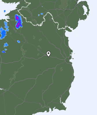 Radar