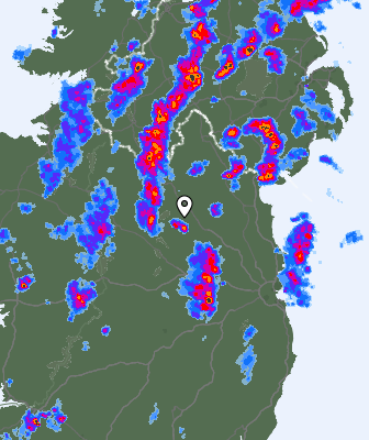 Radar