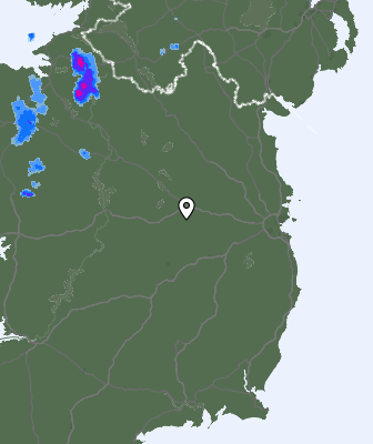 Radar