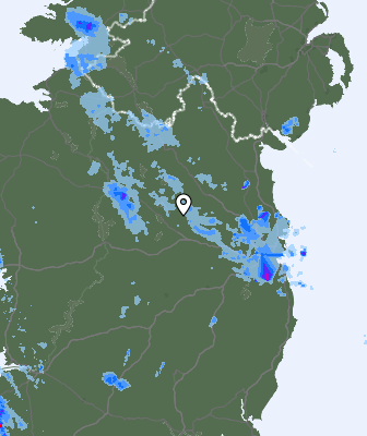Radar