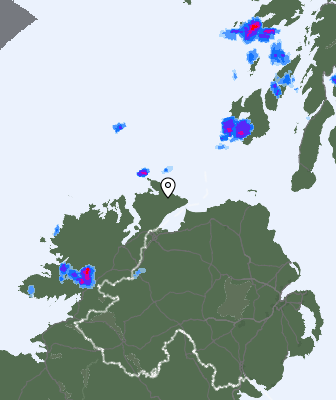 Radar