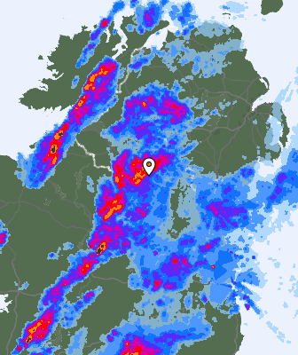 Radar