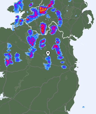 Radar