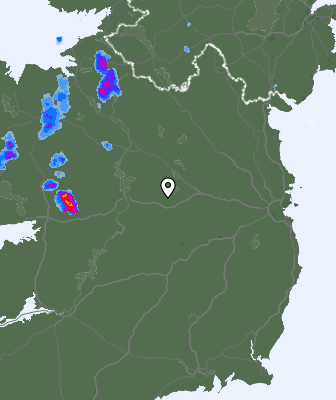 Radar