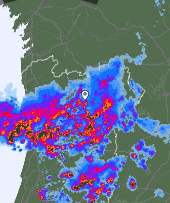 Radar