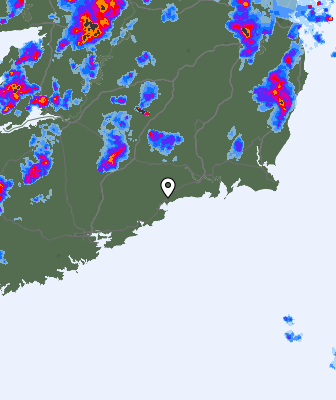 Radar