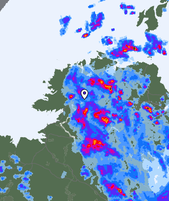 Radar