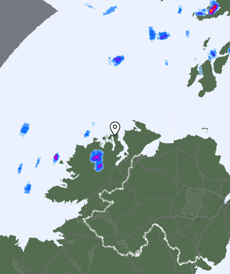 Radar