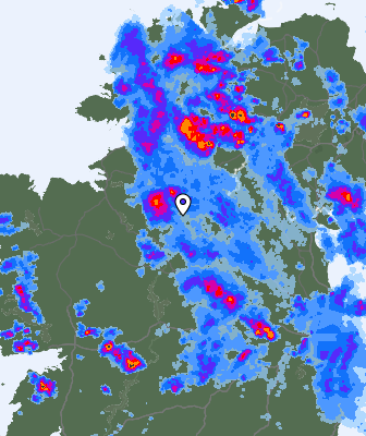 Radar