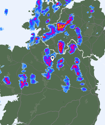Radar